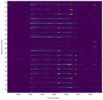 Automatic Detection of Epileptiform Discharges in Extra-cranial Electroencephalography