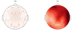 Seizure Detection Tutorials