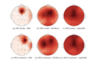 Machine Learning and its Potential to Improve Epilepsy Diagnosis